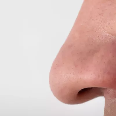 Image: Can&rsquo;t smell because of COVID-19? Retraining your nose might work, experts say
