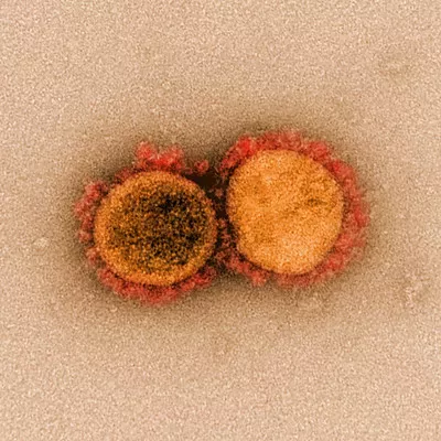 Image: Pima County Health Director: A Map of Infected Individuals is ‘Meaningless’