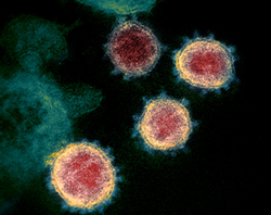 First Coronavirus Death In Pima County