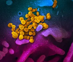 Coronavirus Advice From Abroad: 7 Lessons America’s Governors Should Not Ignore as They Reopen Their Economies