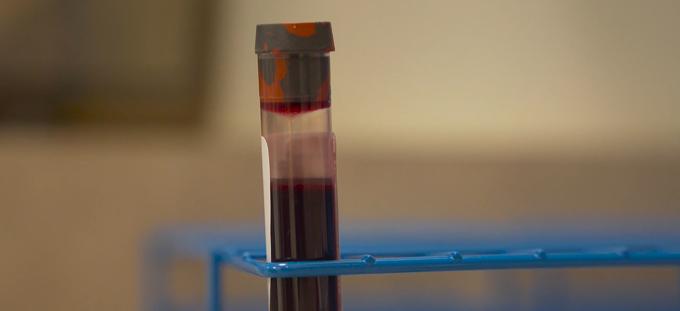 UA, State Expand COVID Antibody Testing to Educators, Food Service Workers