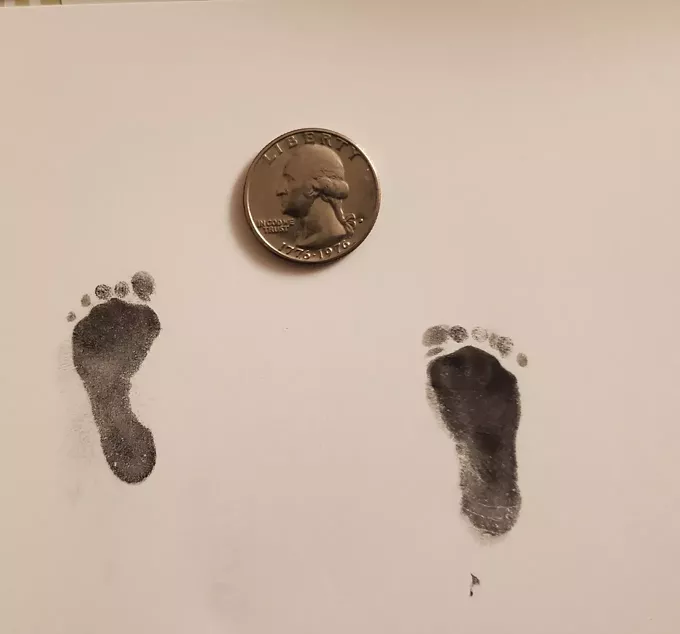 1-Pound Baby Born at Tucson Medical Center