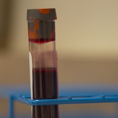 Image: UA, State Expand COVID Antibody Testing to Educators, Food Service Workers
