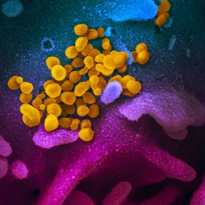 Image: Your Southern AZ Coronavirus AM Roundup for Sunday, April 5: AZ Confirmed Cases Close in on 2300; 64 Now Dead; Stay at Home Order Remains; More N95 Masks Coming from Honeywell